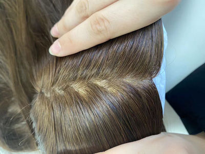 Toupee solution for hair loss for woman - Photo 5