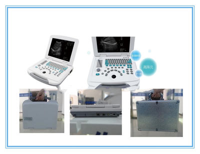 YJ-U500 W2.0 Version Full-Digital Ultrasound Scanner Especificación técnica - Foto 3